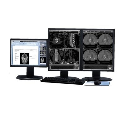 Workspace-PACS-400x400_8dcc0187f67cd51351c0289097eb3cd3